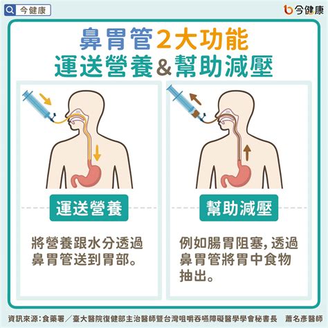 鼻胃管反抽顏色代表意義